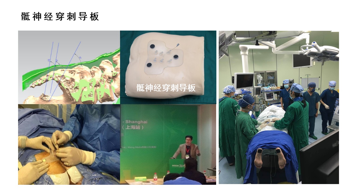 3D打印技術(shù)