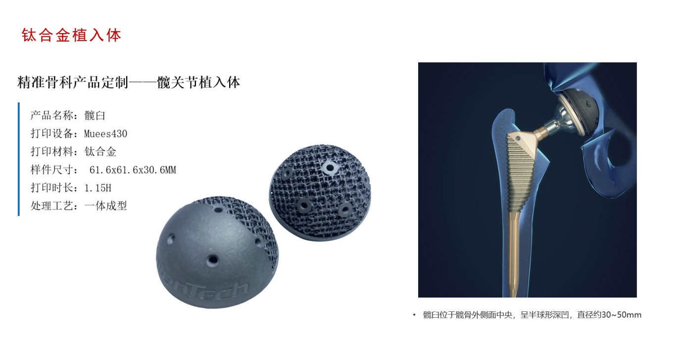 醫(yī)療3D打印技術(shù)