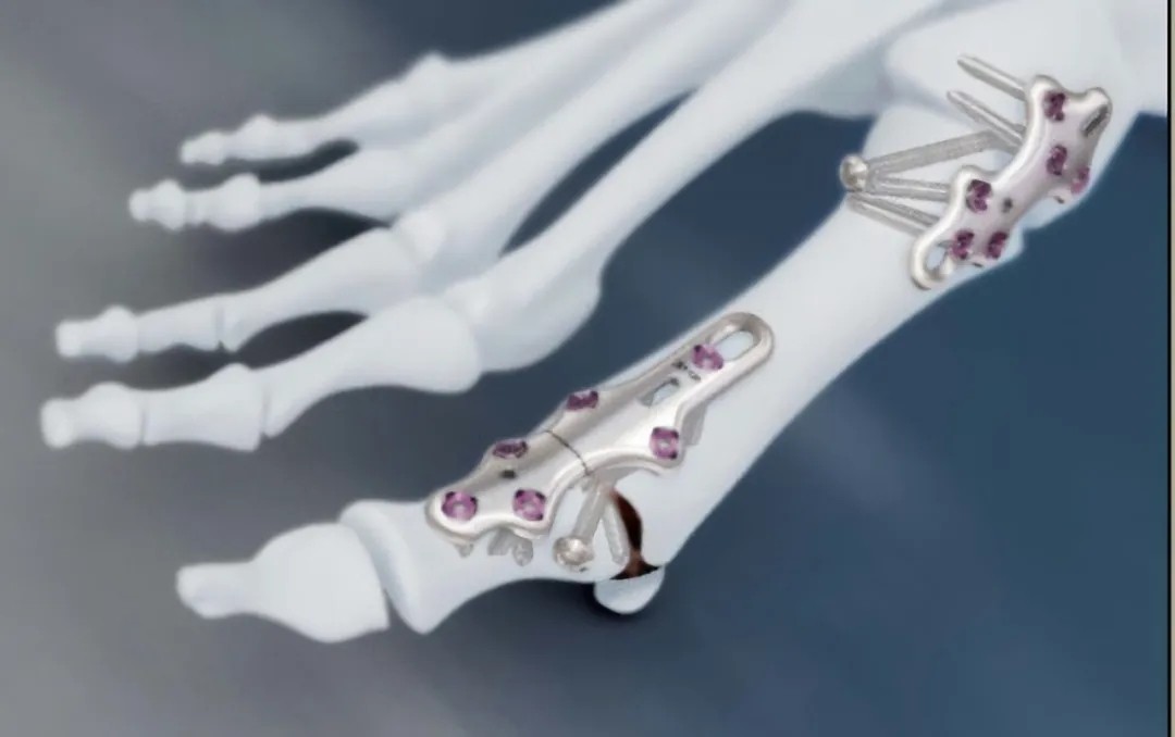 DLP工業(yè)3d打印機